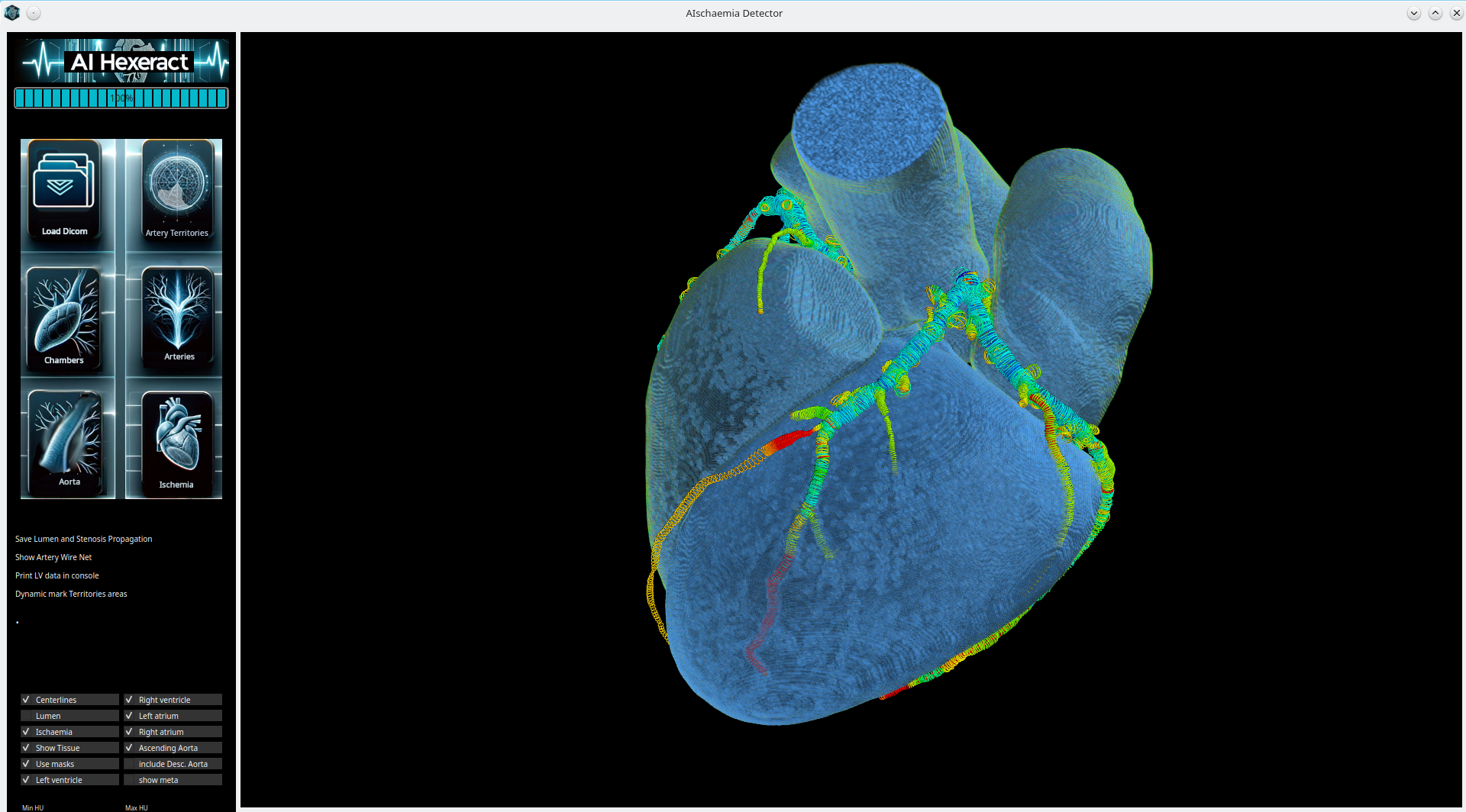 Desktop version – Arteries